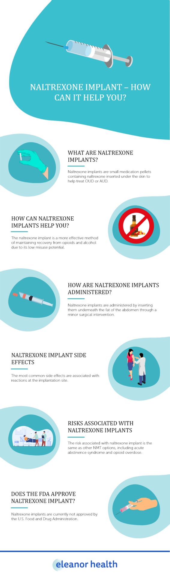Naltrexone Implant – How Can It Help You - Eleanor Health